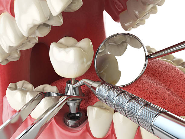 Emergency Gum Pain Relief in MN